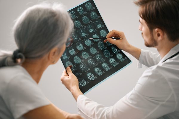 Discover Your Alzheimer’s Risk with Our APOE Test Kit | Home DNA Testing